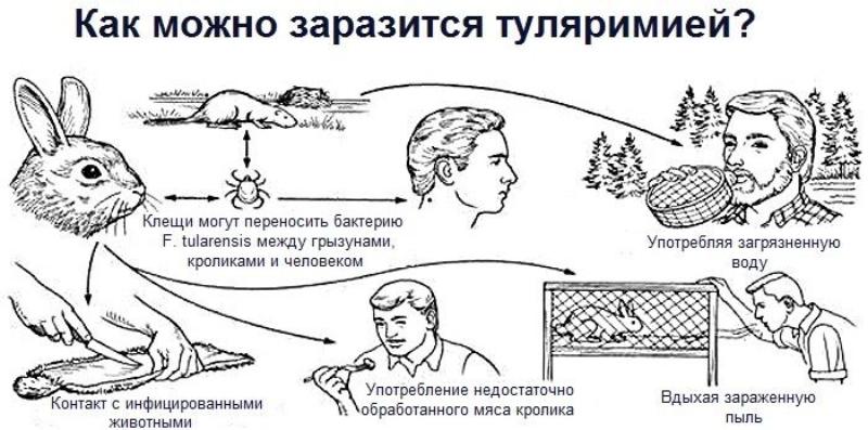 Туляремия: виды, симптомы, причины, профилактика